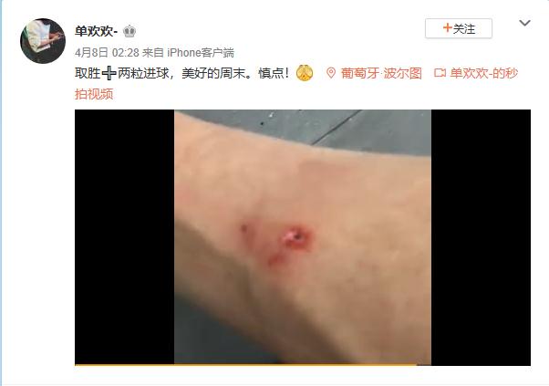 单欢欢小腿被踢伤